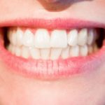Nowoczesna technologia wykorzystywana w salonach stomatologii estetycznej może spowodować, że odbierzemy śliczny uśmiech.